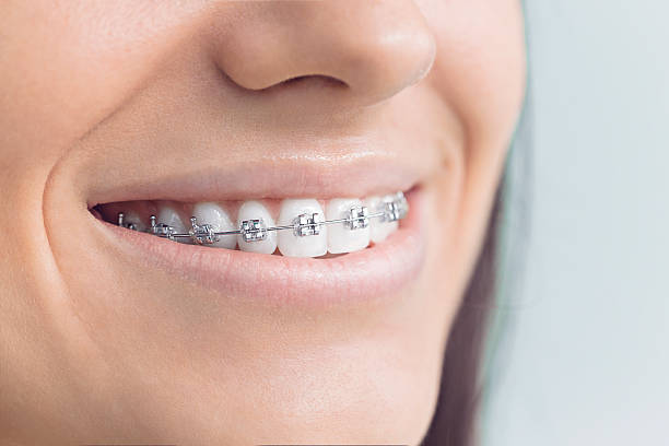 Best Teeth Whitening  in Belle Rose, LA